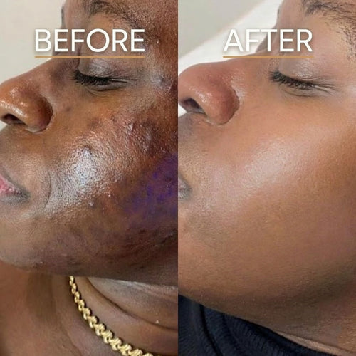 Turmeric Radiance Pads