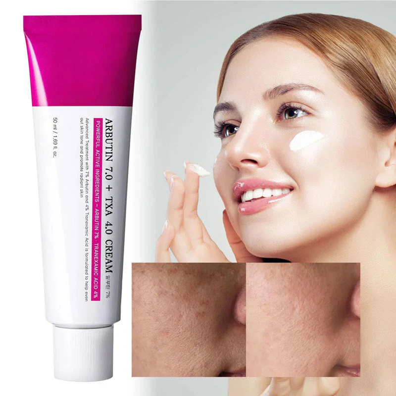 Arbutin Skincare Cream